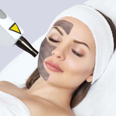 carbon-whitening-2.jpg carbon-whitening-2.jpg